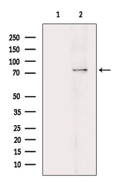 Anti-PKC beta 1 (phospho Ser661) antibody used in Western Blot (WB). GTX04593