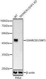Anti-SNF5 antibody [ARC53139] used in Western Blot (WB). GTX04623