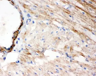 Anti-WISP1 antibody used in IHC (Frozen sections) (IHC-Fr). GTX04633