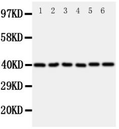 Anti-WISP1 antibody used in Western Blot (WB). GTX04633