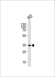Anti-EDA antibody used in Western Blot (WB). GTX04634