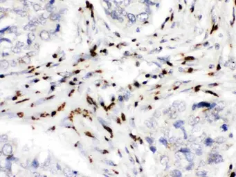 Anti-MDMX / MDM4 antibody used in IHC (Paraffin sections) (IHC-P). GTX04638