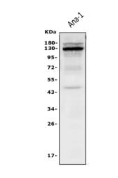 Anti-IL3 Receptor beta antibody used in Western Blot (WB). GTX04641