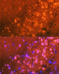 Anti-JNK antibody[ARC0291] used in IHC (Paraffin sections) (IHC-P). GTX04657