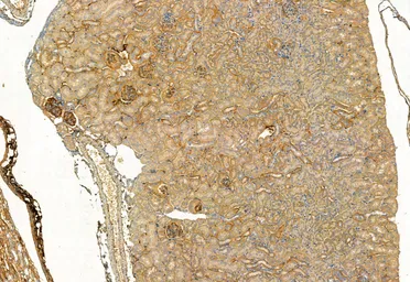 Anti-FAP antibody used in IHC (Paraffin sections) (IHC-P). GTX04673