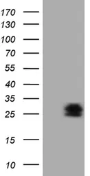 Anti-PMP22 antibody [OTI5D1] used in Western Blot (WB). GTX04688