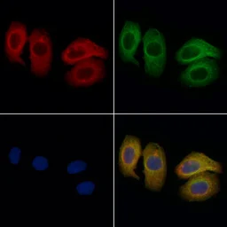 Anti-Fc epsilon R1 alpha antibody used in Immunocytochemistry/ Immunofluorescence (ICC/IF). GTX04729