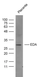 Anti-EDA antibody used in Western Blot (WB). GTX04731