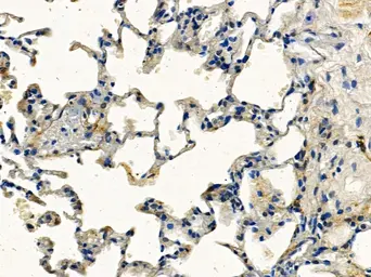 Anti-TLR2 antibody used in IHC (Paraffin sections) (IHC-P). GTX04732