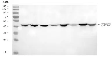 Anti-NDUFS2 antibody used in Western Blot (WB). GTX04733