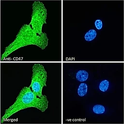 Anti-CD47 antibody used in Immunocytochemistry/ Immunofluorescence (ICC/IF). GTX04816