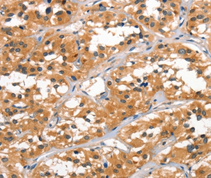 Anti-ALOX15 antibody used in IHC (Paraffin sections) (IHC-P). GTX04843