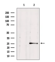 Anti-NUDT21 antibody used in Western Blot (WB). GTX04874