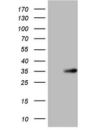 Anti-NR0B2 antibody [OTI7B5] used in Western Blot (WB). GTX04884