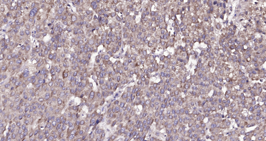 Anti-Amphiregulin antibody used in IHC (Paraffin sections) (IHC-P). GTX04890