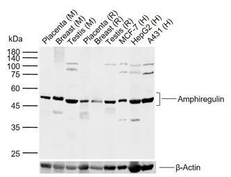 Anti-Amphiregulin antibody used in Western Blot (WB). GTX04890