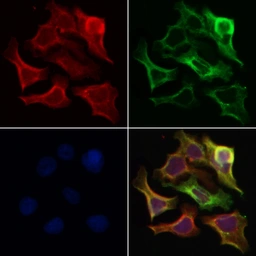 Anti-SMAD1+5+8(9) antibody used in Immunocytochemistry/ Immunofluorescence (ICC/IF). GTX04895