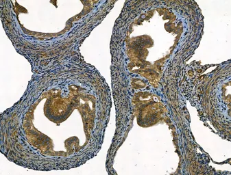 Anti-SMAD1+5+8(9) antibody used in IHC (Paraffin sections) (IHC-P). GTX04895
