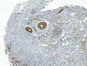 Anti-SMAD1+5+8(9) antibody used in IHC (Paraffin sections) (IHC-P). GTX04895
