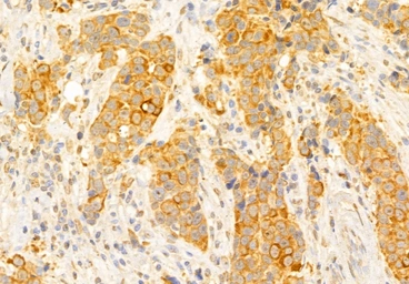 Anti-xCT / SLC7A11 antibody used in IHC (Paraffin sections) (IHC-P). GTX04911