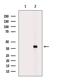 Anti-xCT / SLC7A11 antibody used in Western Blot (WB). GTX04911