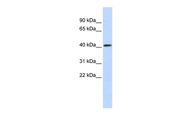 Anti-PARP11 antibody used in Western Blot (WB). GTX04915