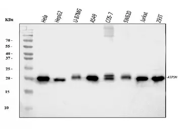 Anti-ATP5H antibody used in Western Blot (WB). GTX04925