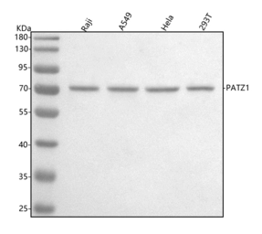 Anti-PATZ1 antibody used in Western Blot (WB). GTX04950