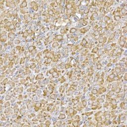Anti-GATSL3 antibody used in IHC (Paraffin sections) (IHC-P). GTX04958