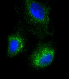 Anti-SFTPC antibody used in Immunocytochemistry/ Immunofluorescence (ICC/IF). GTX04974
