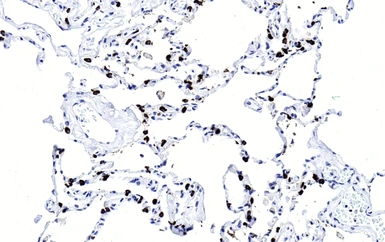 Anti-SFTPC antibody used in IHC (Paraffin sections) (IHC-P). GTX04974