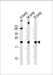 Anti-SFTPC antibody used in Western Blot (WB). GTX04974