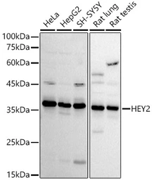 Anti-HEY2 antibody used in Western Blot (WB). GTX04982