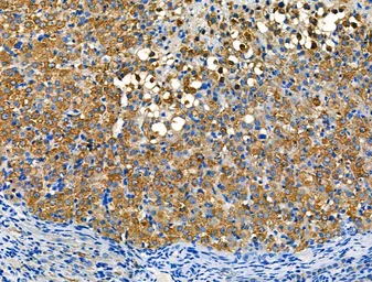 Anti-Interferon gamma antibody used in IHC (Paraffin sections) (IHC-P). GTX04987