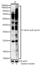 Anti-Lactic acid-Lysine antibody used in Western Blot (WB). GTX05002