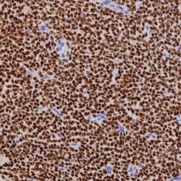 Anti-FOXL2 antibody [FOXL2/7989R] used in IHC (Paraffin sections) (IHC-P). GTX05010