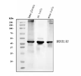 Anti-HSD3B1 antibody [3F3C/7F9C8] used in Western Blot (WB). GTX05017