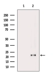 Anti-GPX4 antibody used in Western Blot (WB). GTX05018