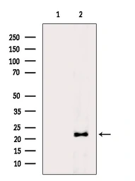 Anti-GPX4 antibody used in Western Blot (WB). GTX05018