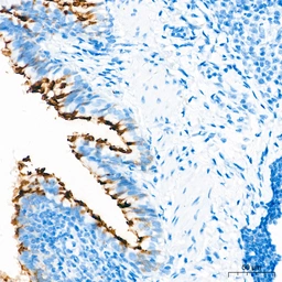 Anti-MUC1 antibody [ARC0352] used in IHC (Paraffin sections) (IHC-P). GTX05027