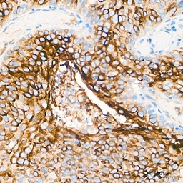Anti-MUC1 antibody [ARC0352] used in IHC (Paraffin sections) (IHC-P). GTX05027