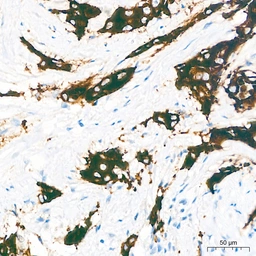 Anti-MUC1 antibody [ARC0352] used in IHC (Paraffin sections) (IHC-P). GTX05027