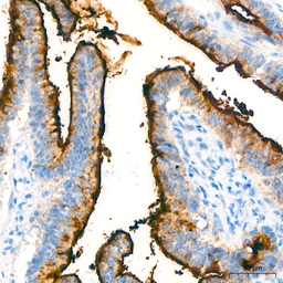 Anti-MUC1 antibody [ARC0352] used in IHC (Paraffin sections) (IHC-P). GTX05027