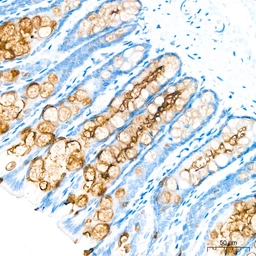 Anti-MUC1 antibody [ARC0352] used in IHC (Paraffin sections) (IHC-P). GTX05027