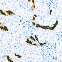 Anti-MUC1 antibody [ARC0352] used in IHC (Paraffin sections) (IHC-P). GTX05027