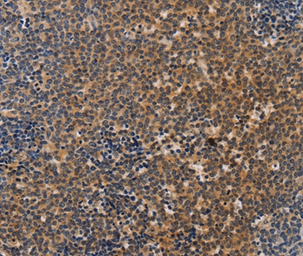Anti-NKp46 antibody used in IHC (Paraffin sections) (IHC-P). GTX05037