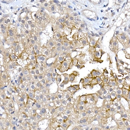 Anti-Aquaporin 9 antibody used in IHC (Paraffin sections) (IHC-P). GTX05046
