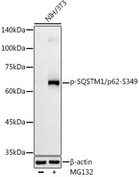 Anti-SQSTM1 / P62 (phospho Ser349) antibody used in Western Blot (WB). GTX05052