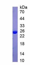 Human CRP protein. GTX05053-pro