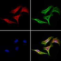 Anti-KDELR2 antibody used in Immunocytochemistry/ Immunofluorescence (ICC/IF). GTX05062